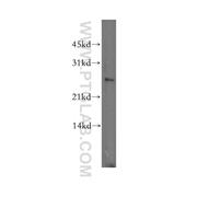 DLX1 Rabbit Polyclonal Antibody (13046-1-AP)