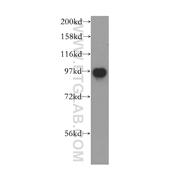 VPS53 Rabbit Polyclonal Antibody (12824-1-AP)