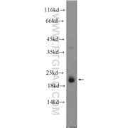 ARL8B Rabbit Polyclonal Antibody (13049-1-AP)