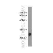 SLAMF7 Rabbit Polyclonal Antibody (12905-1-AP)