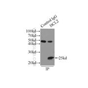 BCL2 Rabbit Polyclonal Antibody (12789-1-AP)