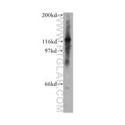 CHTF18 Rabbit Polyclonal Antibody (13030-1-AP)