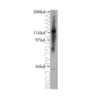 CHTF18 Rabbit Polyclonal Antibody (13030-1-AP)