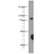 XPO7 Rabbit Polyclonal Antibody (12980-1-AP)