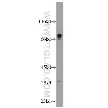 CACNB1 Rabbit Polyclonal Antibody (13039-1-AP)