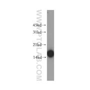 FABP4 Rabbit Polyclonal Antibody (12802-1-AP)