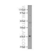 LIPA Rabbit Polyclonal Antibody (12956-1-AP)