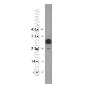 MOBKL1A Rabbit Polyclonal Antibody (12790-1-AP)