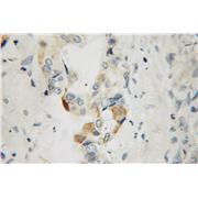 STK33 Rabbit Polyclonal Antibody (12857-1-AP)