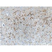 NEFL Rabbit Polyclonal Antibody (12998-1-AP)