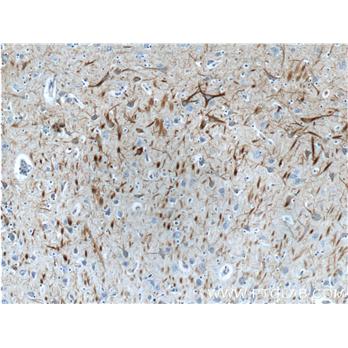 NEFL Rabbit Polyclonal Antibody (12998-1-AP)