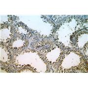 TAF1B Rabbit Polyclonal Antibody (12818-1-AP)