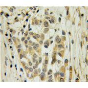 ELAVL4 Rabbit Polyclonal Antibody (13032-1-AP)
