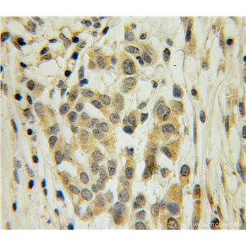 ELAVL4 Rabbit Polyclonal Antibody (13032-1-AP)