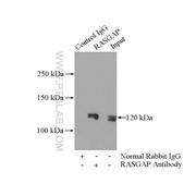 RASA1 Rabbit Polyclonal Antibody (12935-1-AP)