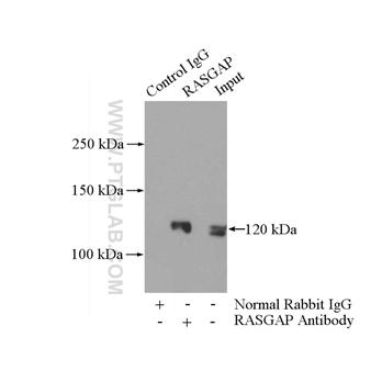RASA1 Rabbit Polyclonal Antibody (12935-1-AP)