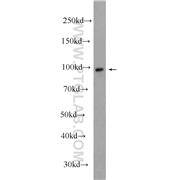 CTNNA1 Rabbit Polyclonal Antibody (12831-1-AP)