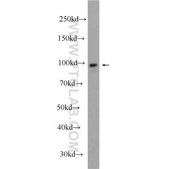 CTNNA1 Rabbit Polyclonal Antibody (12831-1-AP)