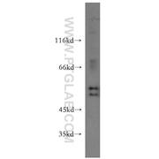 HS1BP3 Rabbit Polyclonal Antibody (12845-1-AP)