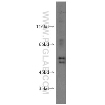 HS1BP3 Rabbit Polyclonal Antibody (12845-1-AP)