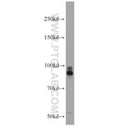 PTPRS Rabbit Polyclonal Antibody (13008-1-AP)