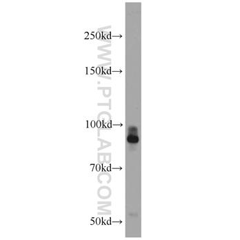 PTPRS Rabbit Polyclonal Antibody (13008-1-AP)