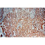 PDK4 Rabbit Polyclonal Antibody (12949-1-AP)