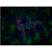 NKX2-2 Rabbit Polyclonal Antibody (13013-1-AP)