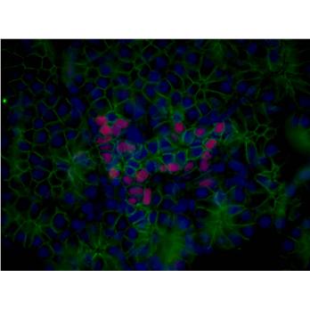 NKX2-2 Rabbit Polyclonal Antibody (13013-1-AP)