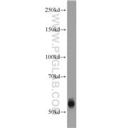 TMPRSS6 Rabbit Polyclonal Antibody (12950-1-AP)