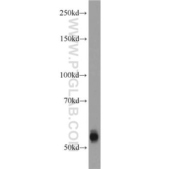 TMPRSS6 Rabbit Polyclonal Antibody (12950-1-AP)