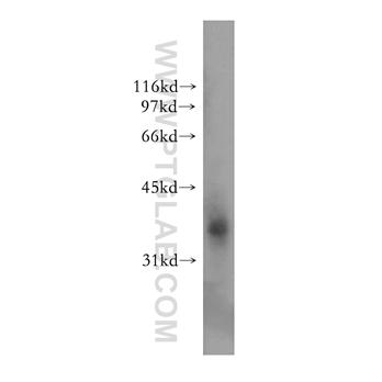 EXTL2 Rabbit Polyclonal Antibody (12828-1-AP)