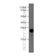 PPM1A Rabbit Polyclonal Antibody (12961-1-AP)