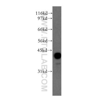 PPM1A Rabbit Polyclonal Antibody (12961-1-AP)