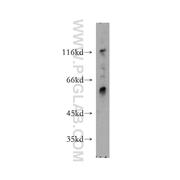 MAP4K5 Rabbit Polyclonal Antibody (12827-1-AP)