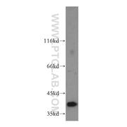 RRAGB Rabbit Polyclonal Antibody (13023-1-AP)