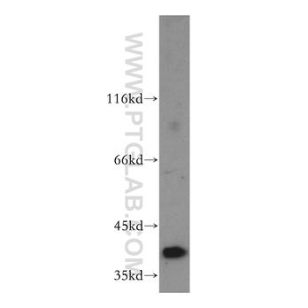 RRAGB Rabbit Polyclonal Antibody (13023-1-AP)
