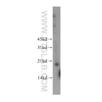 TPRKB Rabbit Polyclonal Antibody (12800-1-AP)