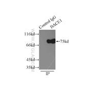 BACE1 Rabbit Polyclonal Antibody (12807-1-AP)