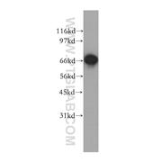 GSPT2 Rabbit Polyclonal Antibody (12989-1-AP)