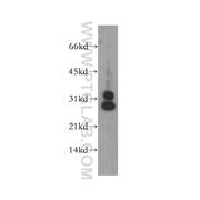 CENPH Rabbit Polyclonal Antibody (12841-1-AP)