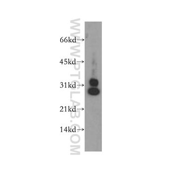 CENPH Rabbit Polyclonal Antibody (12841-1-AP)
