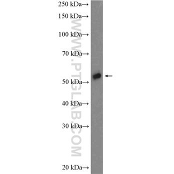 TRAF5 Rabbit Polyclonal Antibody (12868-1-AP)