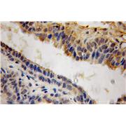 ACP6 Rabbit Polyclonal Antibody (12965-1-AP)