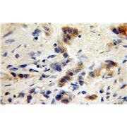 GABRG1 Rabbit Polyclonal Antibody (12871-1-AP)