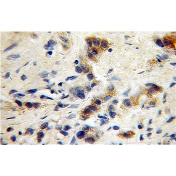 GABRG1 Rabbit Polyclonal Antibody (12871-1-AP)