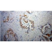 GSDMB Rabbit Polyclonal Antibody (12885-1-AP)