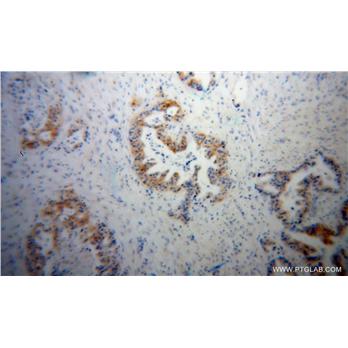 GSDMB Rabbit Polyclonal Antibody (12885-1-AP)