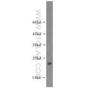 NUDT16 Rabbit Polyclonal Antibody (12889-1-AP)