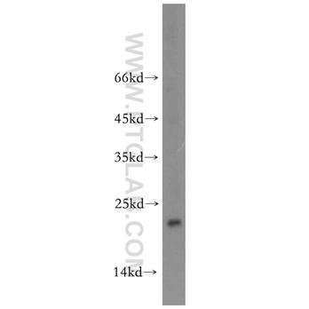 NUDT16 Rabbit Polyclonal Antibody (12889-1-AP)